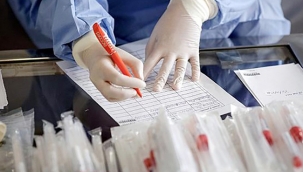 Hollanda'da vaka sayılarındaki yükseliş devam ediyor