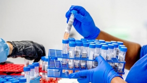 Alman başhekimin iğneyle öldürdüğü korona hastalarından biri Hollanda vatandaşı