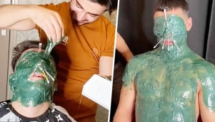 Cilt uzmanları, Hollanda'daki berberin TİKTOK videoları konusunda halkı uyardı