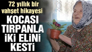 72 yıllık bir vahşet hikayesi! Kocası tırpanla iki elini bileklerinden kesti