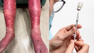 COVİD-19 AŞISINDA 'YAN ETKİ' KABUSU