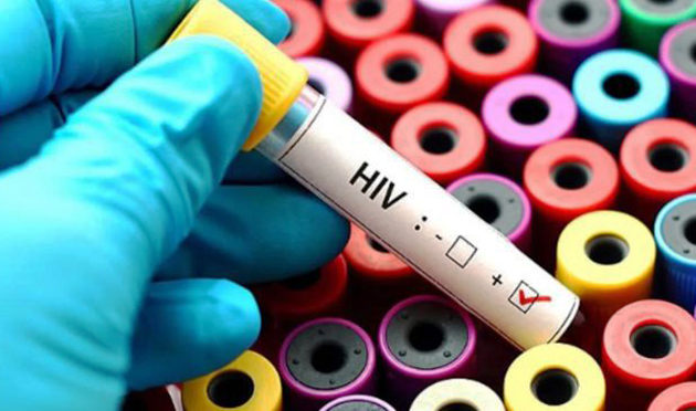 Hollanda'da HIV virüsünün daha zararlı ve bulaşıcı varyantı ortaya çıktı