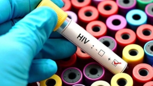 Hollanda'da HIV virüsünün daha zararlı ve bulaşıcı varyantı ortaya çıktı