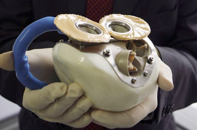 Hollanda'da ilk yapay kalp nakli yapılan hasta hayatını kaybetti