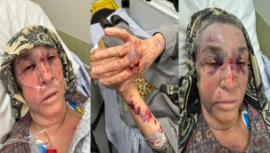 Irkçı Hollandalı komşusu tarafından saldırıya uğrayan 82 yaşındaki Türk kadın ölümden döndü