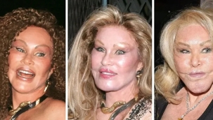 Kediye benzemek için defalarca estetik ameliyatı olan kadın hayatını kaybetti