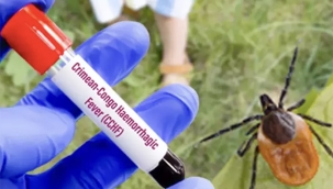 İzin sezonu yaklaşıyor. Uzmanlar, kene ölümlerine dikkat çekti