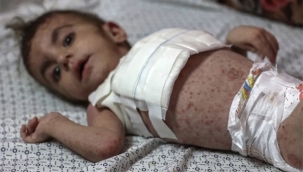 Gazze'den İki Ağır Hasta Çocuk Tedavi İçin Hollanda'ya Getiriliyor