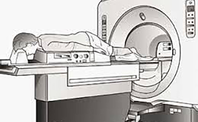 Hollanda'da Yoğun Meme Dokusuna Sahip Kadınlara Ek MRI Taraması Geliyor: Ama 2030’da!