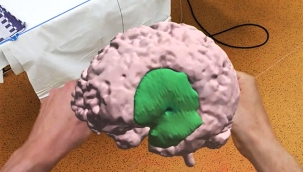 Amsterdam UMC'de İlk Kez Hologram Destekli Beyin Ameliyatı Gerçekleştirildi