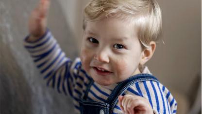 Hollanda Genelinde 1 Yaşındaki Sietse İçin Seferberlik: “Her 1 Euro Çok Önemli”