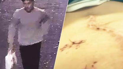 Amsterdam’da Bıçaklı Saldırıya Uğrayan 18 yaşındaki Gencin Hayatı Son Anda Polis Kurtarıldı