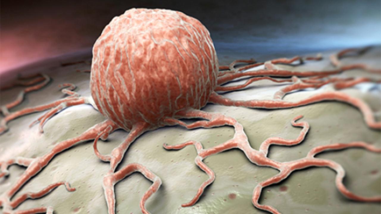 Uzmanlardan Uyarı: “Bu Belirtileri Hafife Almayın” – Kanserin 10 Olası Erken İşareti